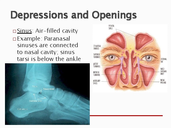 Depressions and Openings � Sinus: Air-filled cavity � Example: Paranasal sinuses are connected to