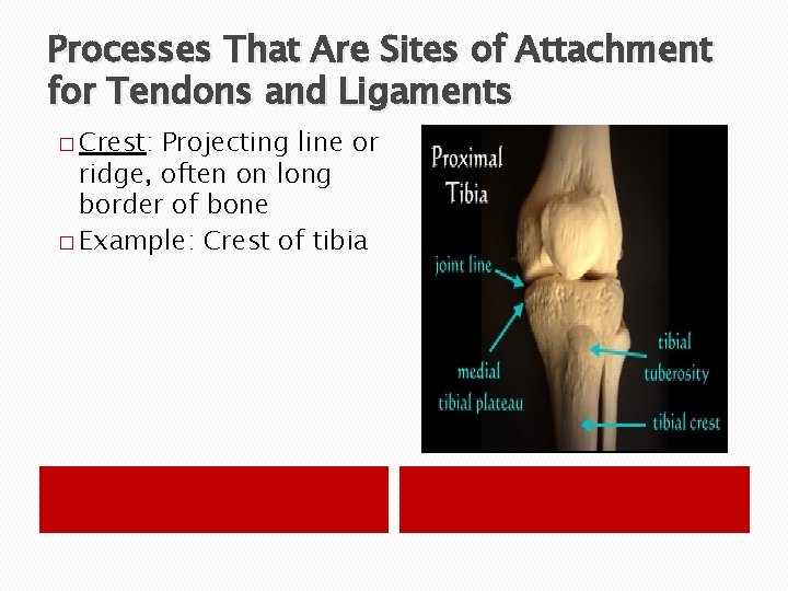 Processes That Are Sites of Attachment for Tendons and Ligaments � Crest: Projecting line