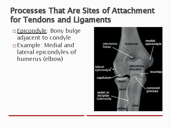 Processes That Are Sites of Attachment for Tendons and Ligaments � Epicondyle: Bony bulge
