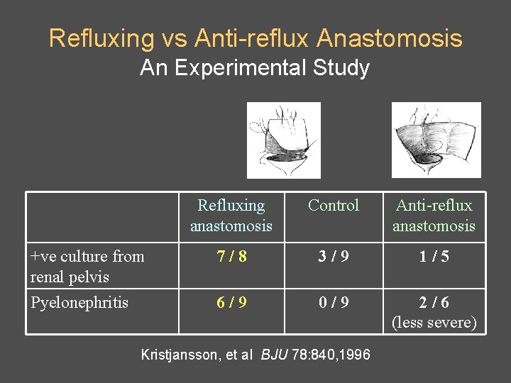 Refluxing vs Anti-reflux Anastomosis An Experimental Study Refluxing anastomosis Control Anti-reflux anastomosis +ve culture