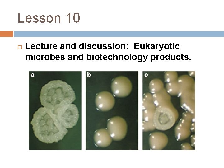 Lesson 10 Lecture and discussion: Eukaryotic microbes and biotechnology products. 