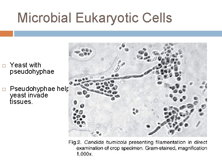 Microbial Eukaryotic Cells Yeast with pseudohyphae Pseudohyphae help yeast invade tissues. 