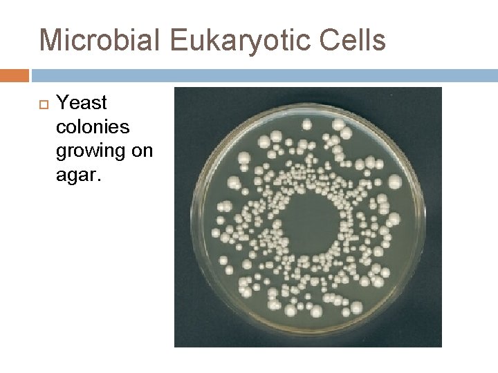 Microbial Eukaryotic Cells Yeast colonies growing on agar. 