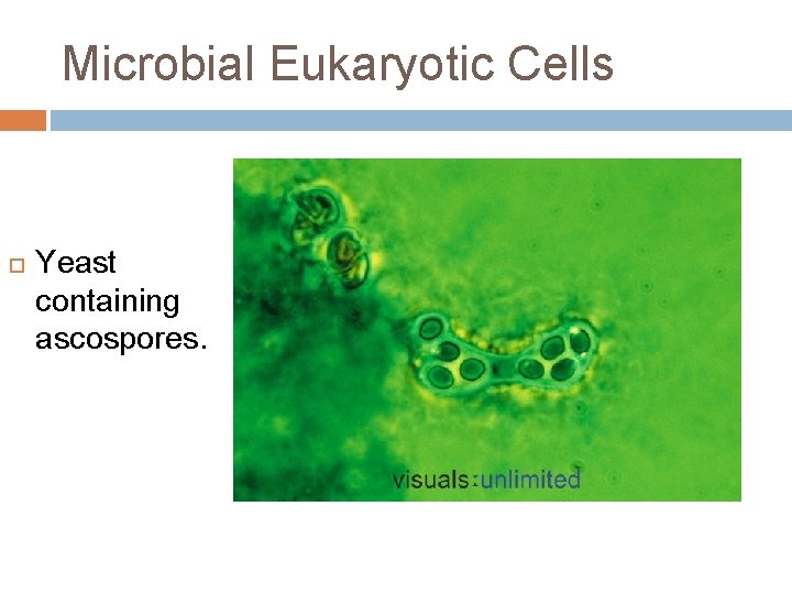 Microbial Eukaryotic Cells Yeast containing ascospores. 