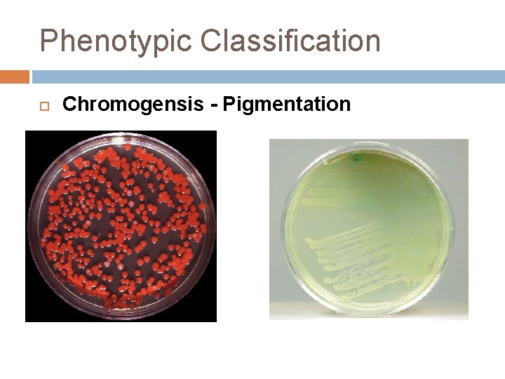 Phenotypic Classification Chromogensis - Pigmentation 