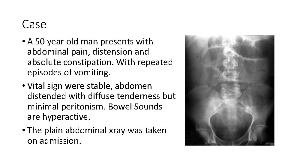 Case • A 50 year old man presents with abdominal pain, distension and absolute