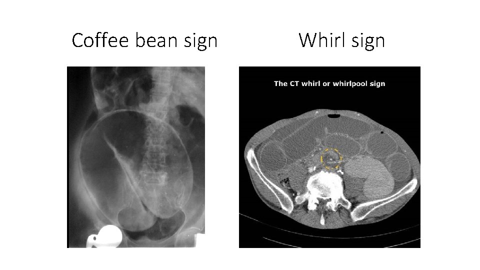 Coffee bean sign Whirl sign Coffee bean sign Whirl sign
