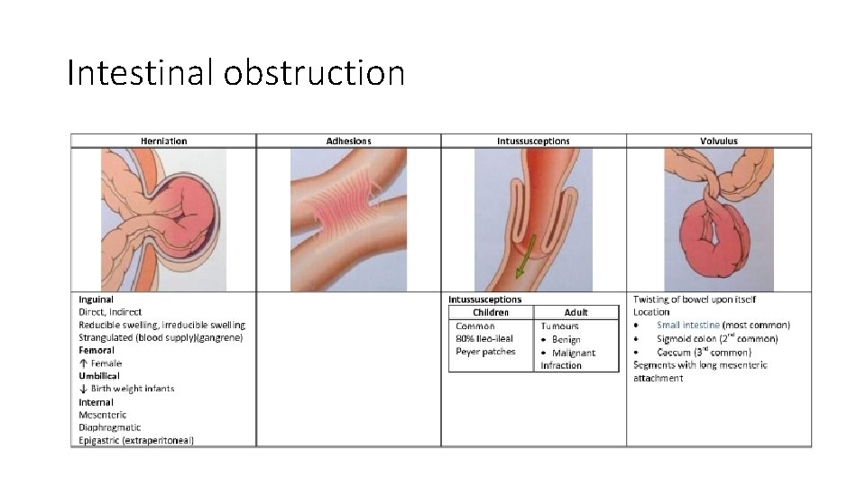 Intestinal obstruction 