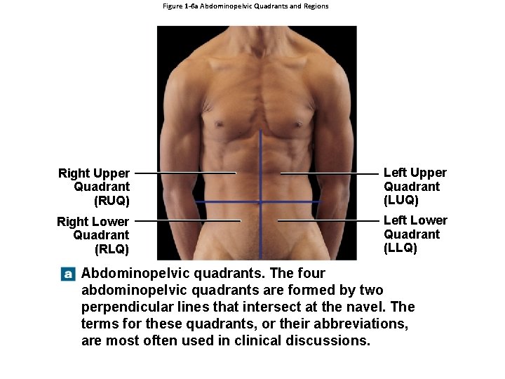 Figure 1 -6 a Abdominopelvic Quadrants and Regions Right Upper Quadrant (RUQ) Left Upper