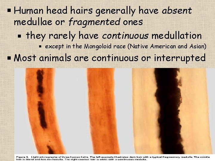 Human head hairs generally have absent medullae or fragmented ones they rarely have continuous