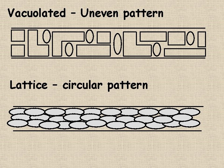 Vacuolated – Uneven pattern Lattice – circular pattern 