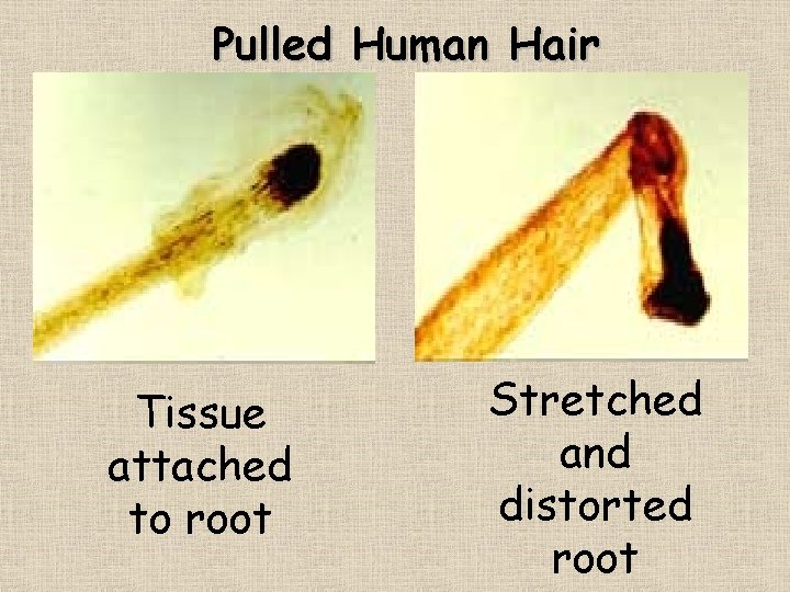 Pulled Human Hair Tissue attached to root Stretched and distorted root 