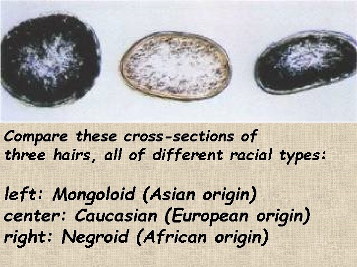 Compare these cross-sections of three hairs, all of different racial types: left: Mongoloid (Asian