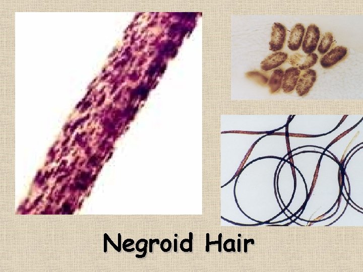 Negroid Hair 