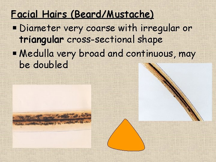 Facial Hairs (Beard/Mustache) Diameter very coarse with irregular or triangular cross-sectional shape Medulla very