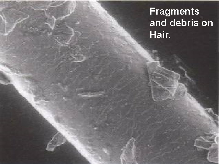 Fragments and debris on Hair. 