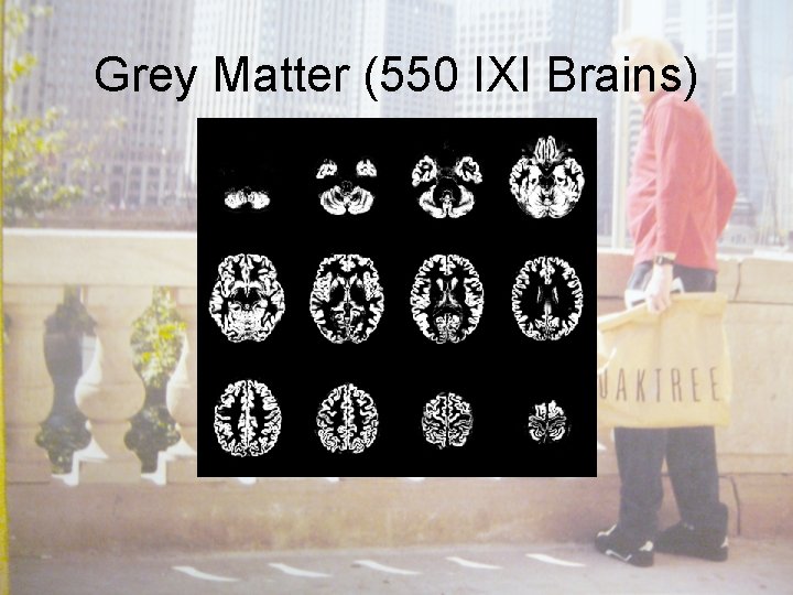 Grey Matter (550 IXI Brains) 