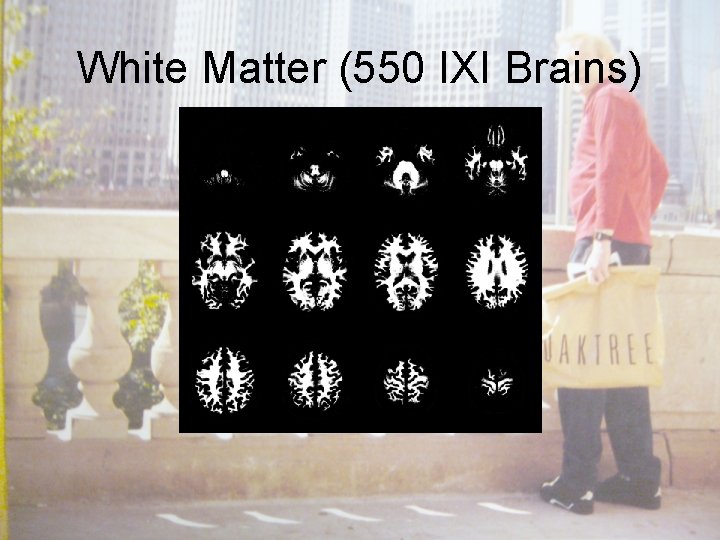 White Matter (550 IXI Brains) 