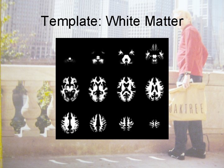 Template: White Matter 