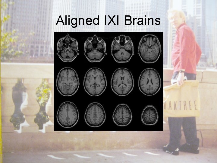 Aligned IXI Brains 