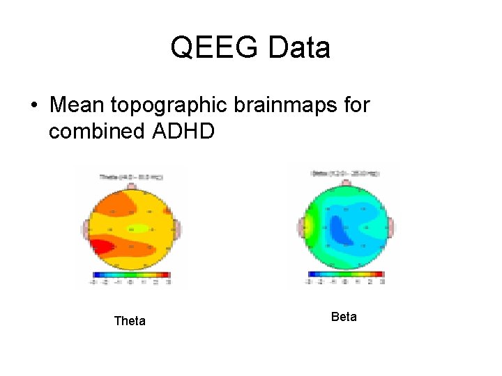 QEEG Data • Mean topographic brainmaps for combined ADHD Theta Beta 