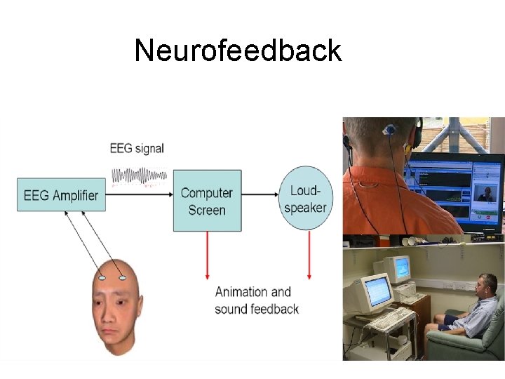 Neurofeedback 