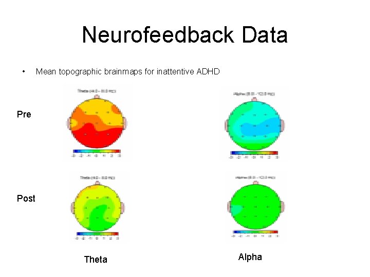 Neurofeedback Data • Mean topographic brainmaps for inattentive ADHD Pre Post Theta Alpha 