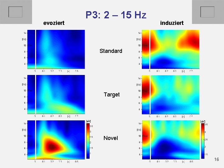 evoziert P 3: 2 – 15 Hz induziert Standard Target [m. V] Novel 16