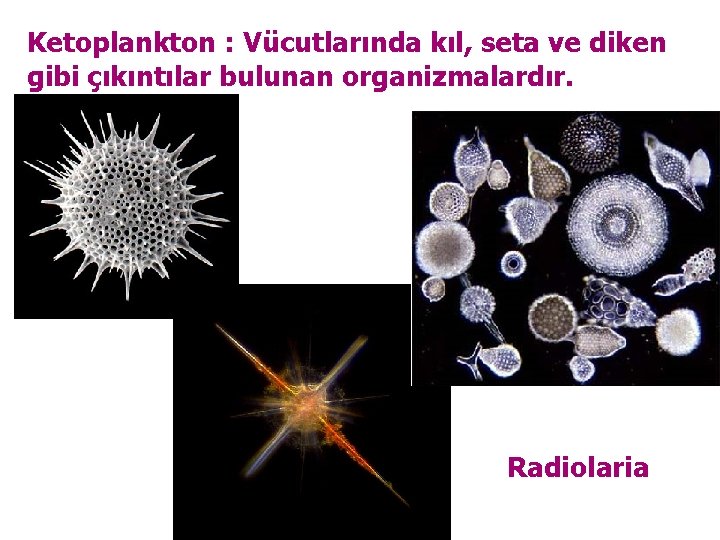 Ketoplankton : Vücutlarında kıl, seta ve diken gibi çıkıntılar bulunan organizmalardır. Radiolaria 