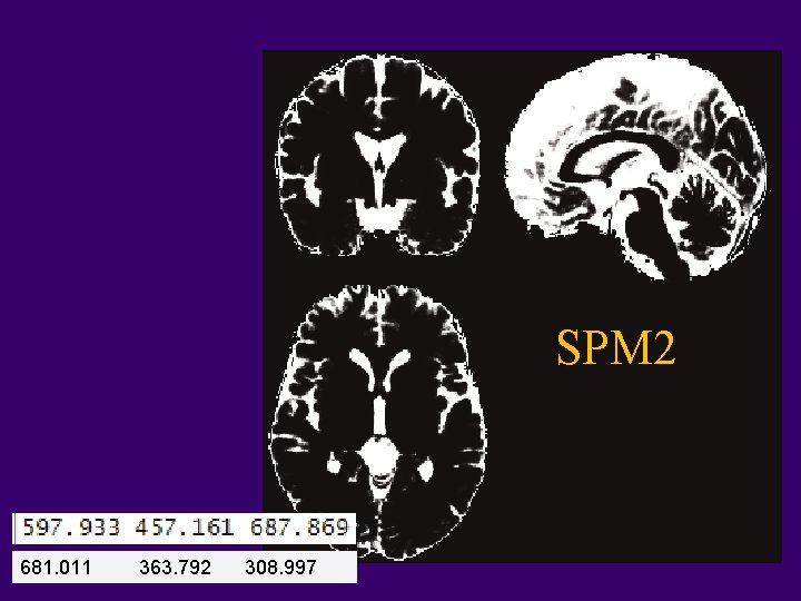 SPM 2 681. 011 363. 792 308. 997 