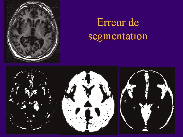 Erreur de segmentation 