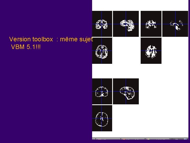 Version toolbox : même sujet VBM 5. 1!!! 