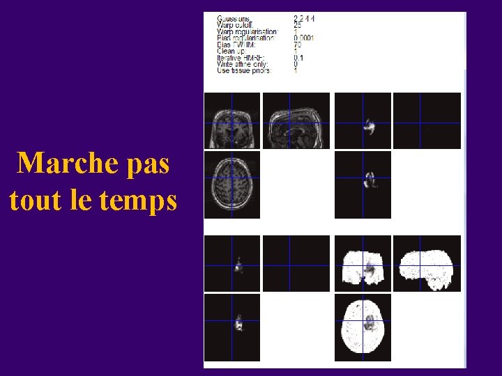 Marche pas tout le temps 