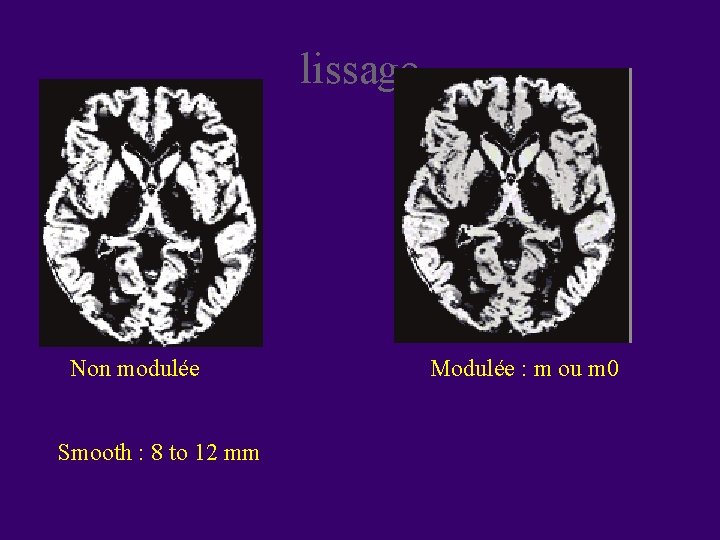 lissage Non modulée Smooth : 8 to 12 mm Modulée : m ou m