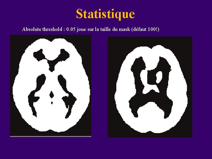 Statistique Absolute threshold : 0. 05 joue sur la taille du mask (défaut 100!)