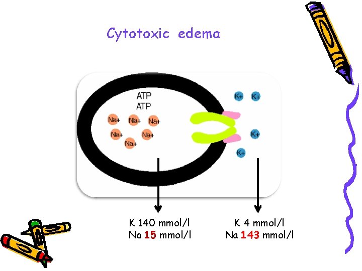 Cytotoxic edema K 140 mmol/l Na 15 mmol/l K 4 mmol/l Na 143 mmol/l
