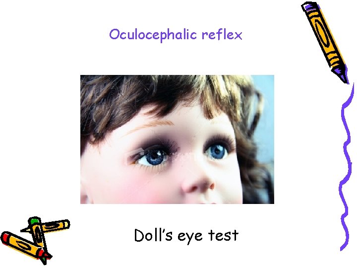 Oculocephalic reflex Doll’s eye test 