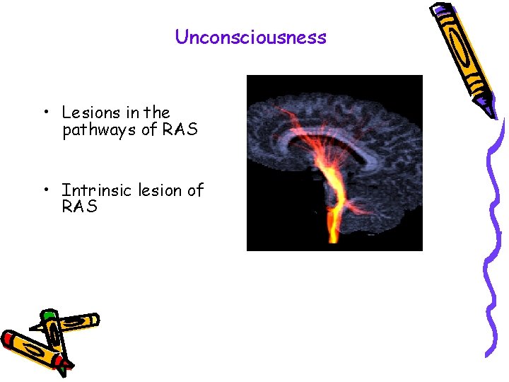 Unconsciousness • Lesions in the pathways of RAS • Intrinsic lesion of RAS 