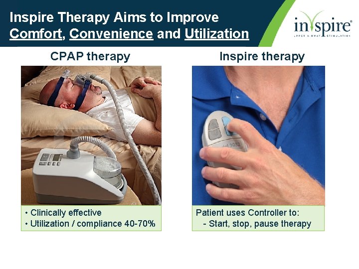 Inspire Therapy Aims to Improve Comfort, Convenience and Utilization CPAP therapy • Clinically effective