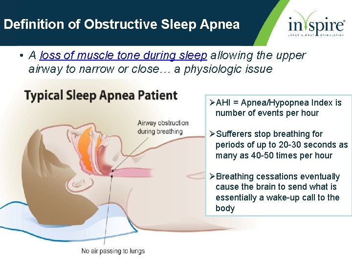 Definition of Obstructive Sleep Apnea • A loss of muscle tone during sleep allowing