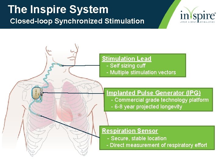 The Inspire System Closed-loop Synchronized Stimulation Lead - Self sizing cuff - Multiple stimulation