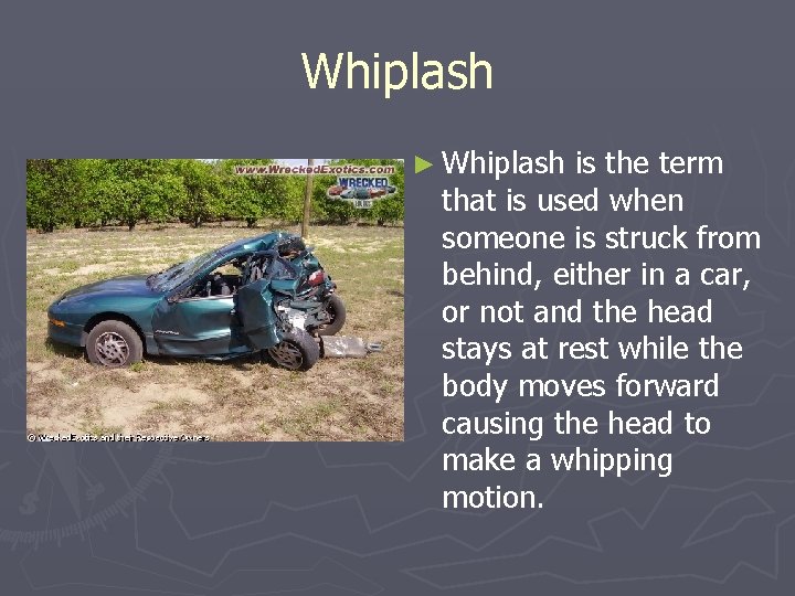 Whiplash ► Whiplash is the term that is used when someone is struck from