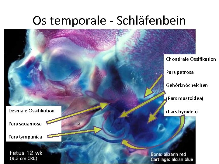 Os temporale - Schläfenbein Chondrale Ossifikation Pars petrosa Gehörknöchelchen (Pars mastoidea) Desmale Ossifikation Pars