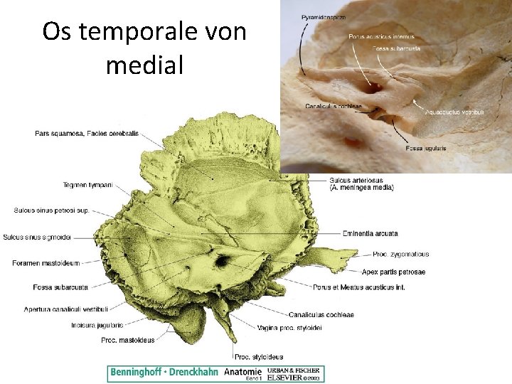 Os temporale von medial 