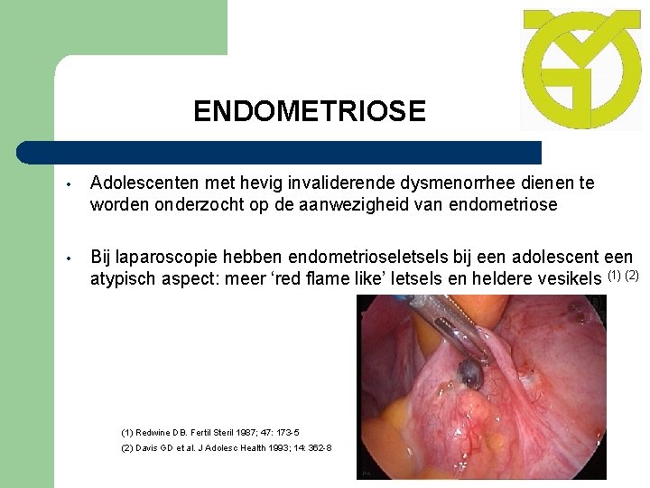 ENDOMETRIOSE • Adolescenten met hevig invaliderende dysmenorrhee dienen te worden onderzocht op de aanwezigheid