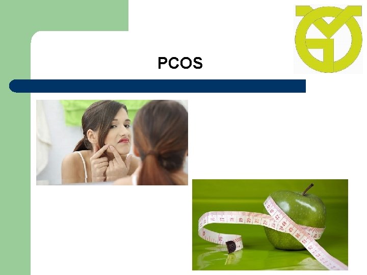 PCOS 