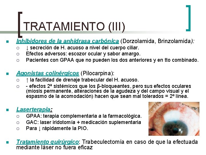 TRATAMIENTO (III) n Inhibidores de la anhidrasa carbónica (Dorzolamida, Brinzolamida): ¡ ¡ ¡ n