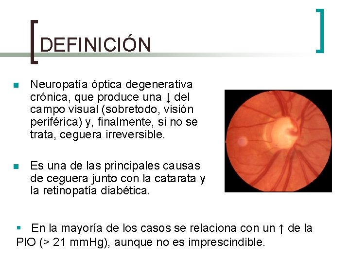 DEFINICIÓN n Neuropatía óptica degenerativa crónica, que produce una ↓ del campo visual (sobretodo,