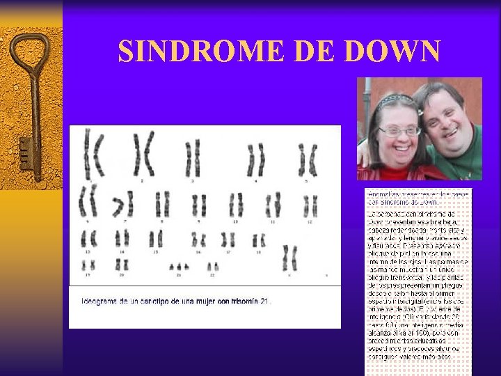 SINDROME DE DOWN 