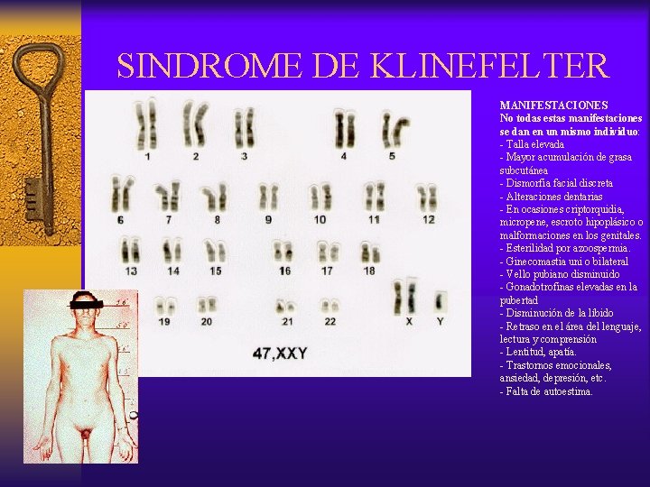 SINDROME DE KLINEFELTER MANIFESTACIONES No todas estas manifestaciones se dan en un mismo individuo: